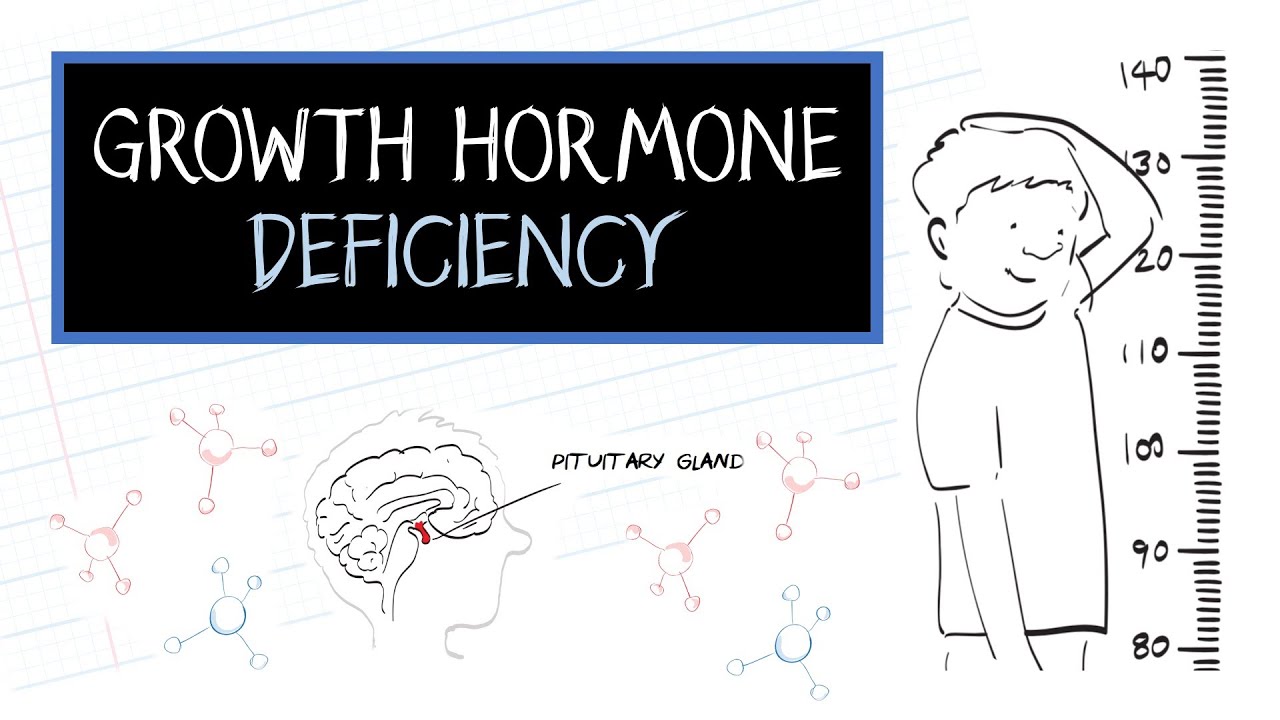 growth hormone deficiency