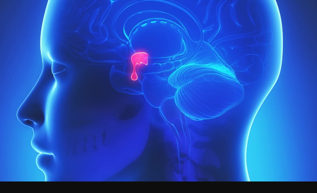 hypopituitarism