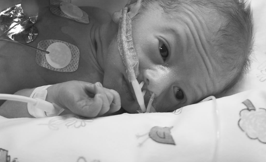 intrauterine growth restriction