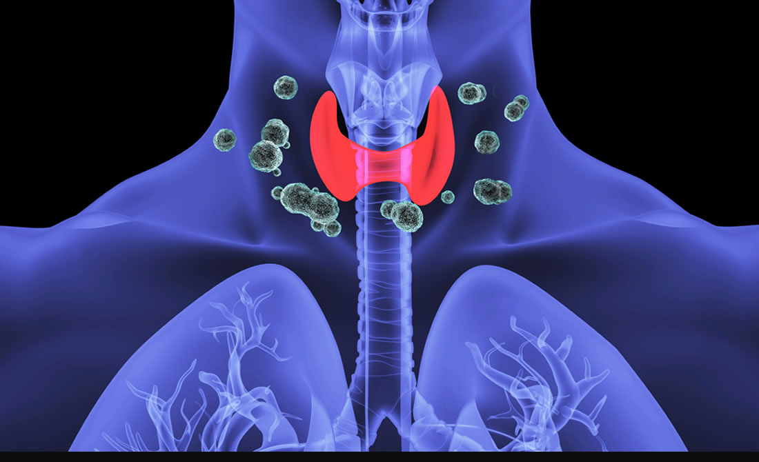 thyroid disorders